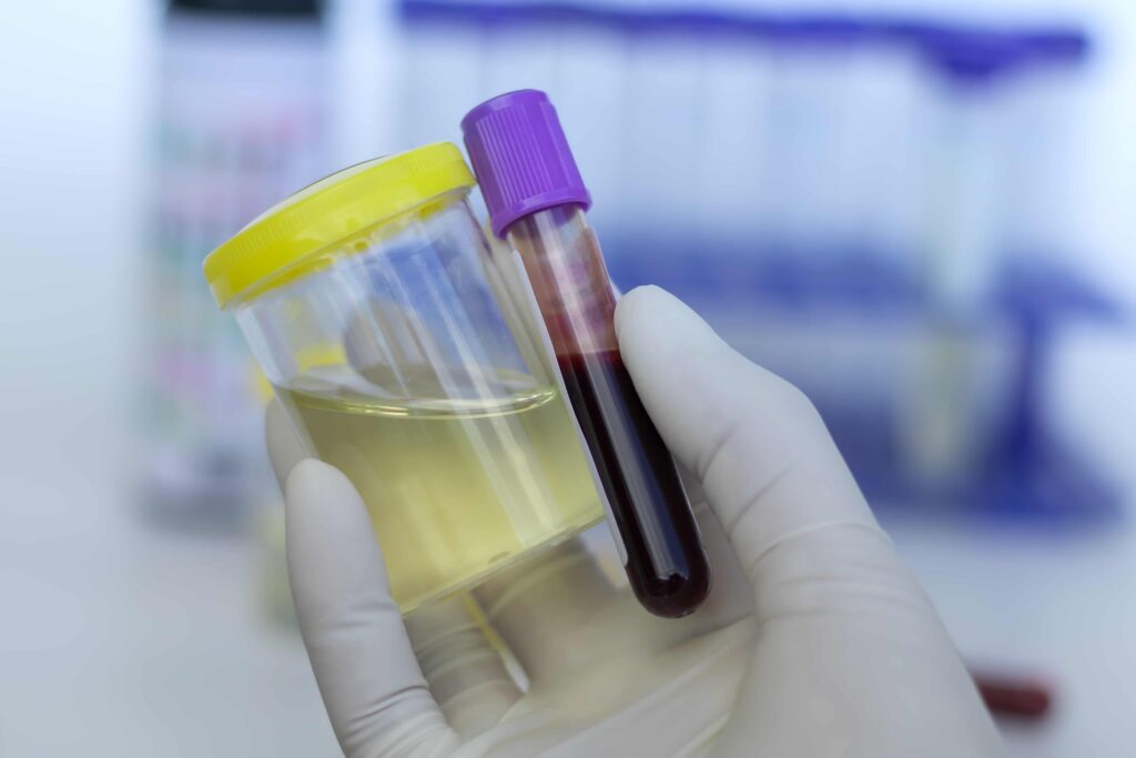 Blood and urine samples in containers